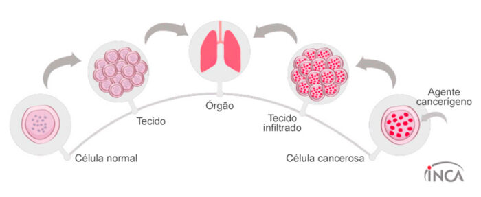 o que é câncer